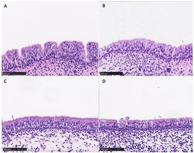 Safety and Efficacy of Topical Chitogel- Deferiprone-Gallium Protoporphyrin in Sheep Model